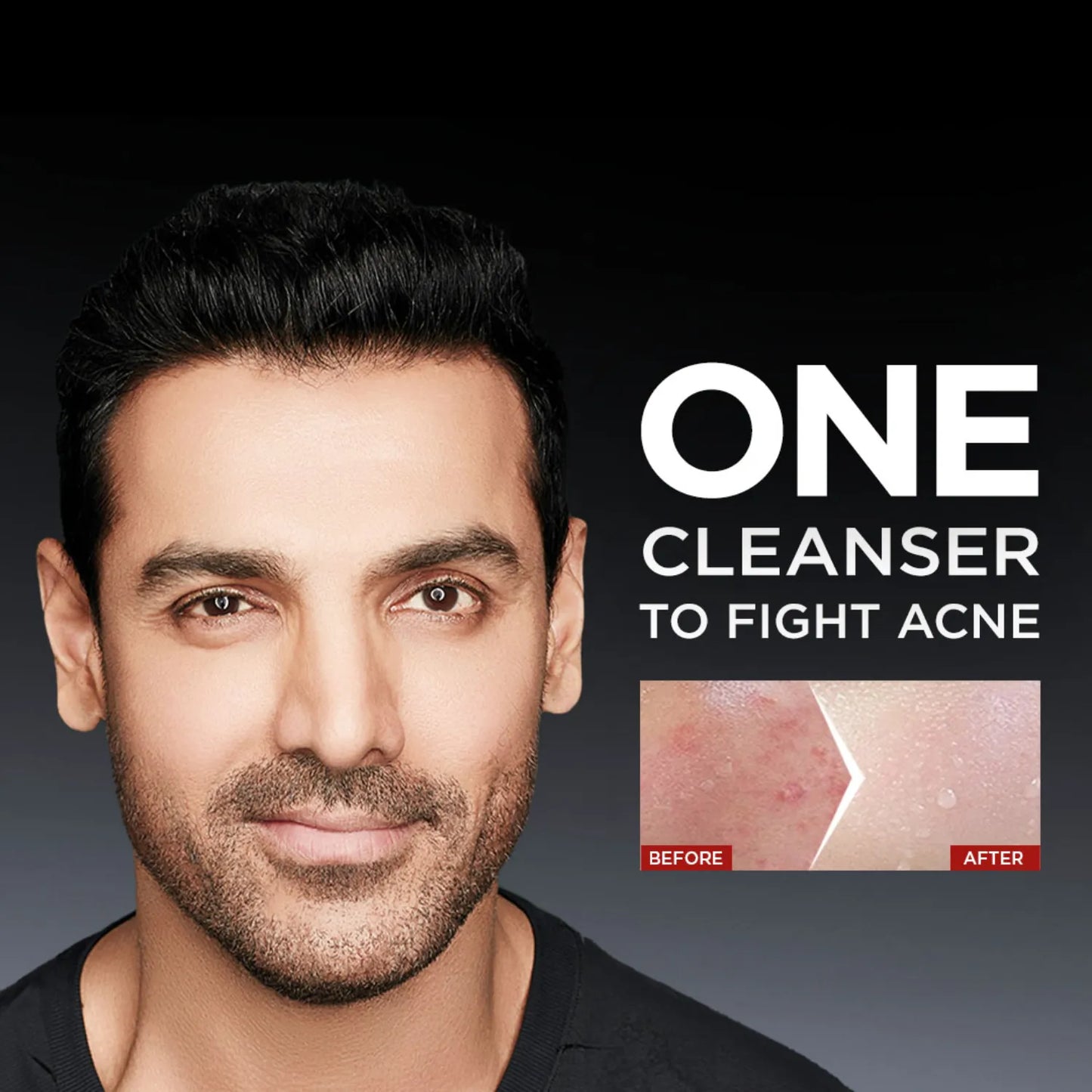 AcnoFight Men's Anti-Pimple Face Wash – 100g