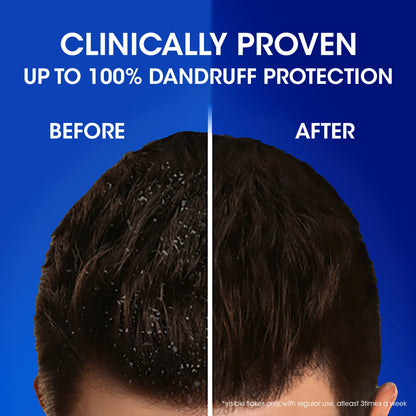 HEAD & SHOULDERS Anti-Dandruff Shampoo