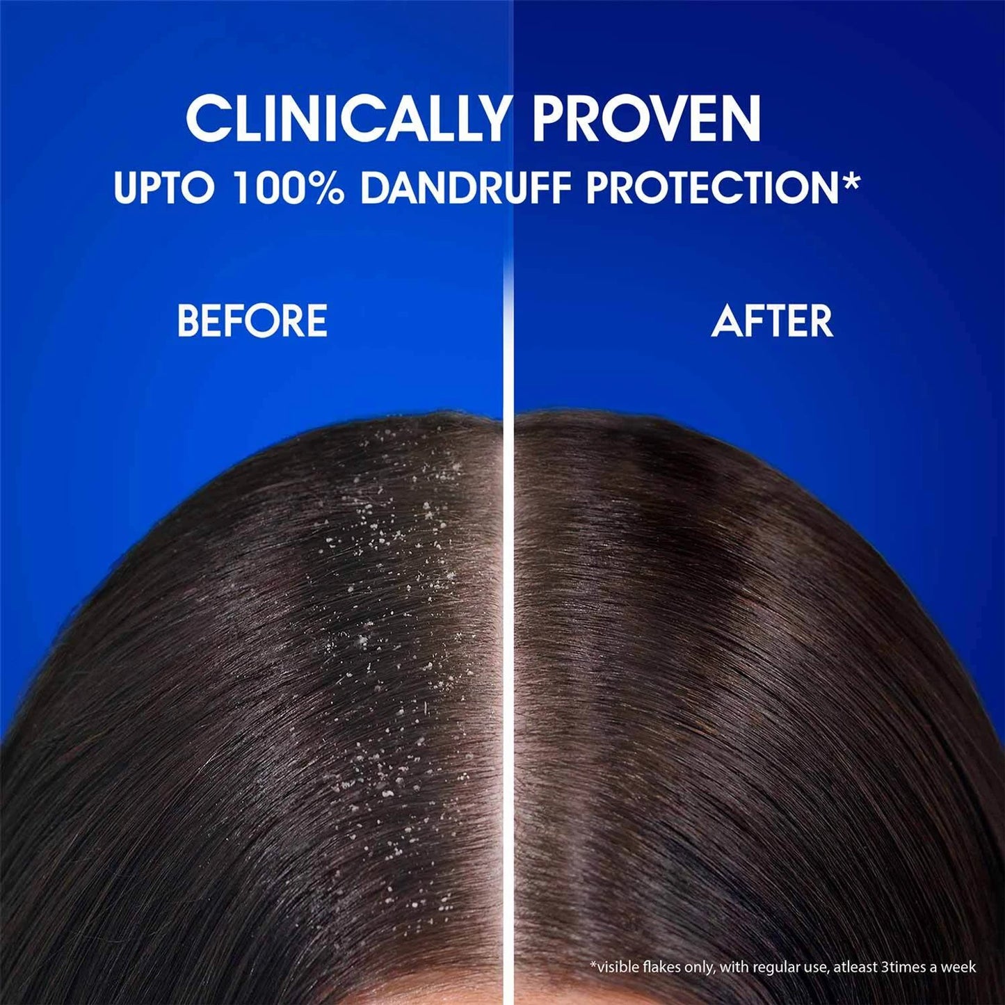 HEAD & SHOULDERS Anti-Dandruff Shampoo